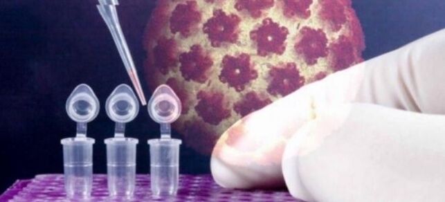 Diagnostik HPV menggunakan tes digene