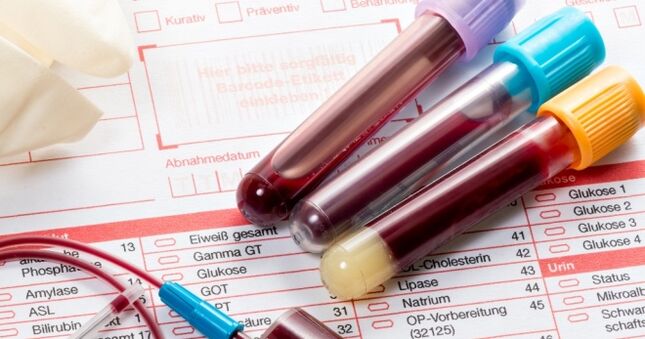 Tes darah untuk human papillomavirus